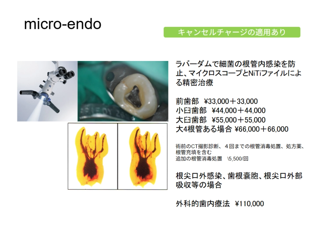 micro-endoについて